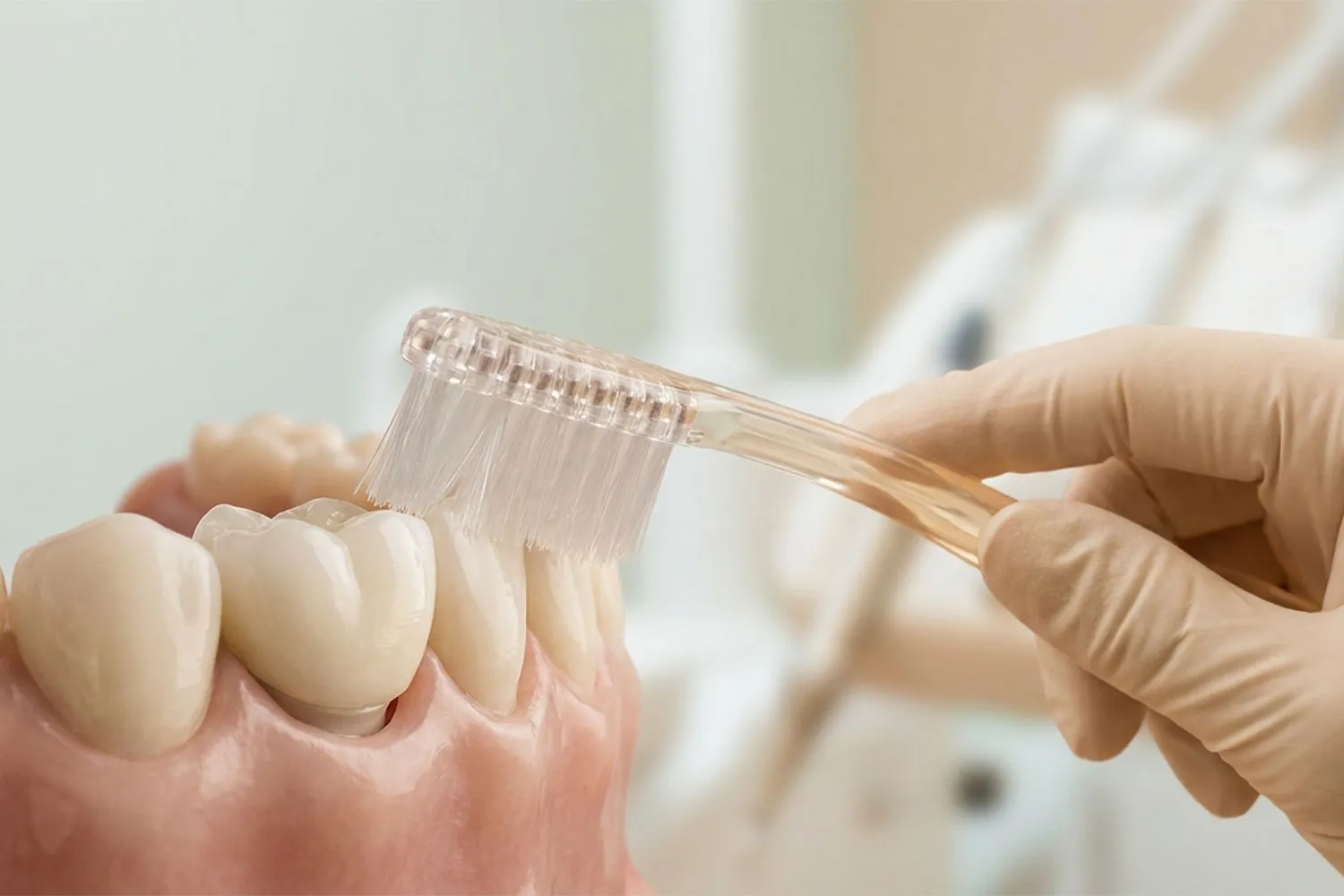 مراقبت پس از پروتز دندان dental prosthesis care guide