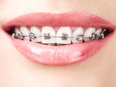اردتودنسی دندان کلینیک دندانپزشکی روشا