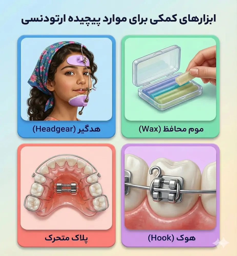 ابزارهای کمکی ارتودنسی auxiliary tools