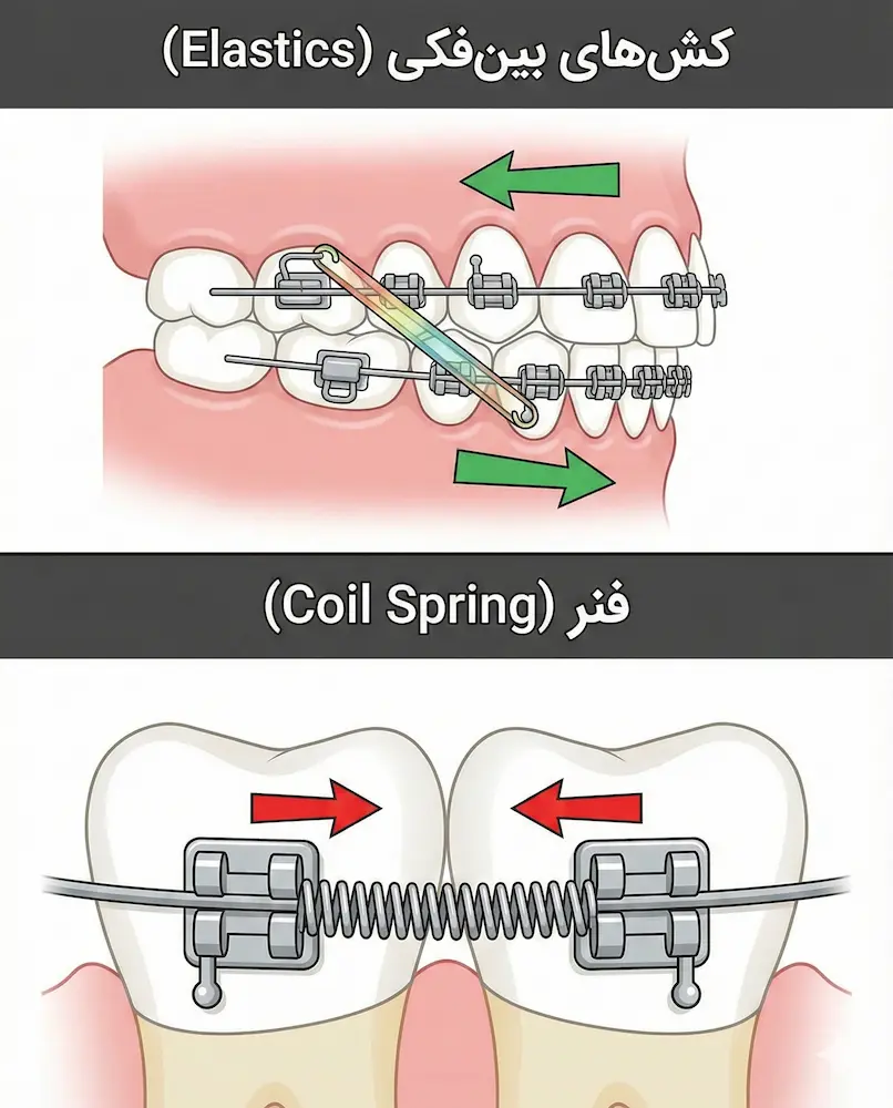 کشها و فنرهای ارتودنسی elastic and coil spring
