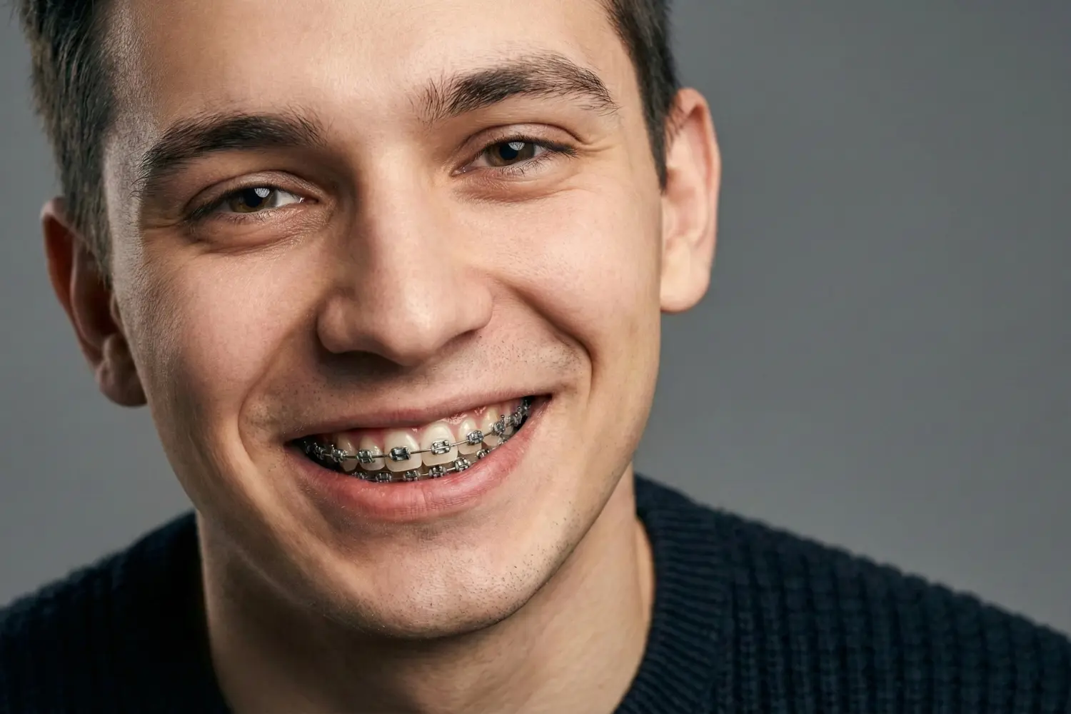 اجزای ارتودنسی orthodontic-options