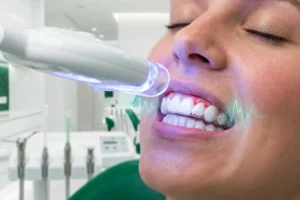 عوارض بلیچینگ دندان bleaching side effects