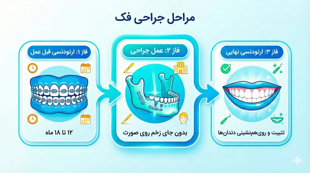 مراحل جراحی فک jaw surgery Roadmap