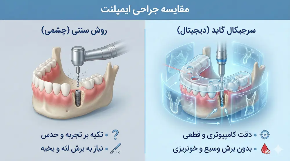 مقایسه روش سنتی و روش دیجیتال کاشت ایمپلنت freehand vs guided implant