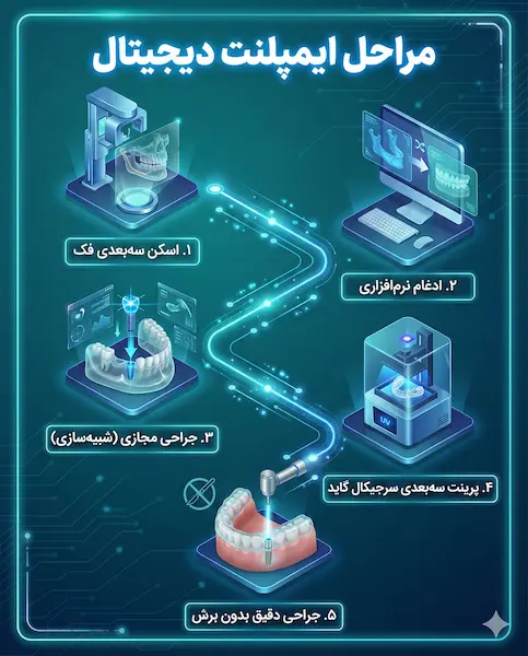 مراحل ایمپلنت دیجیتال با سرجیکال گاید steps of digital implant with surgical guide