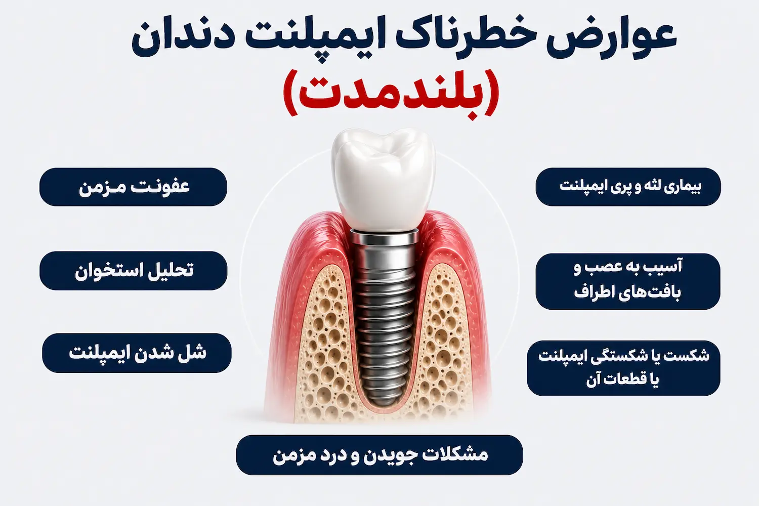 عوارض خطرناک ایمپلنت