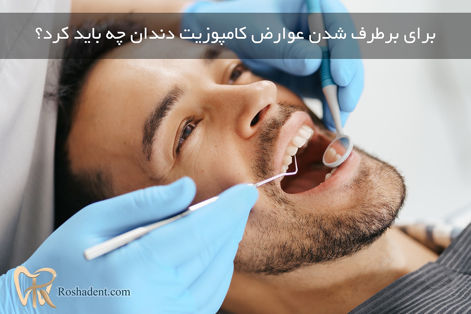 برای برطرف شدن عوارض کامپوزیت دندان چه باید کرد؟