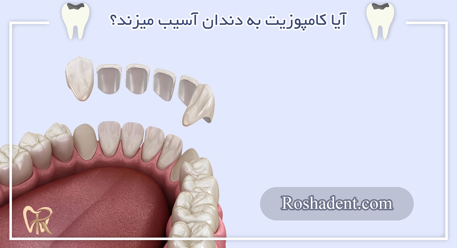آیا کامپوزیت به دندان آسیب میزند؟