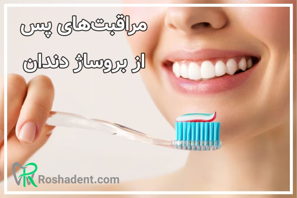 مراقبت‌های پس از بروساژ دندان 