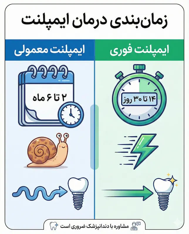 تفاوت مدت زمان ایمپلنت فوری و معمولی immediate load vs default implant