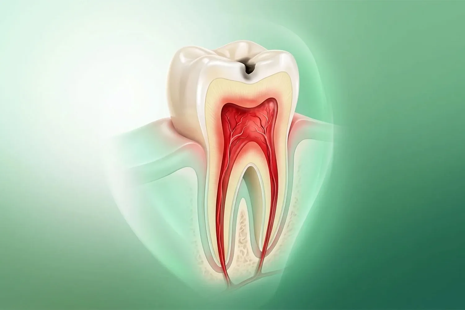 عصب کشی دندان چیست root canal treatment