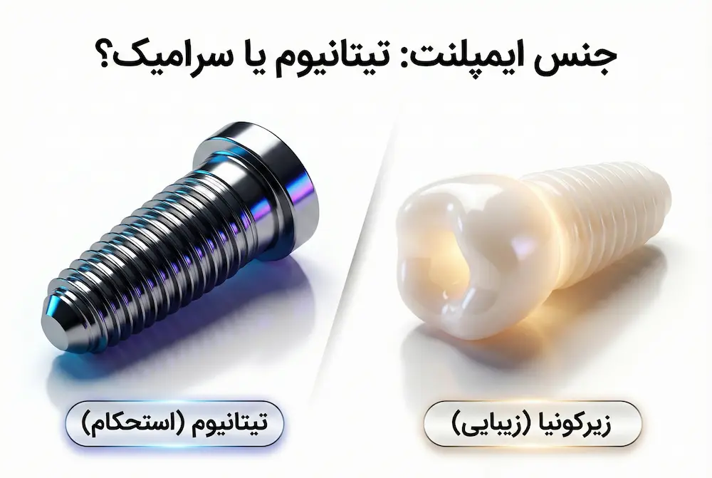 انواع جنس ایمپلنت types of implant