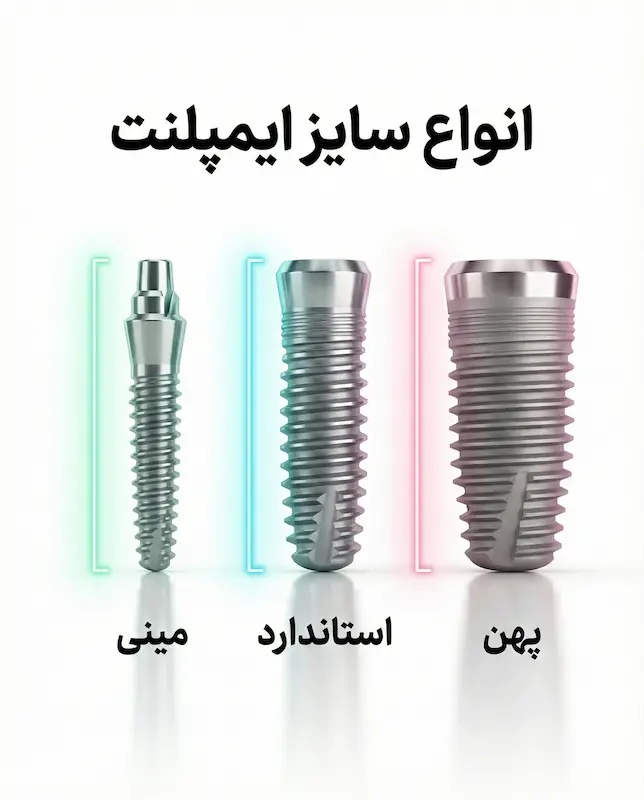 انواع سایز ایمپلنت types of implant