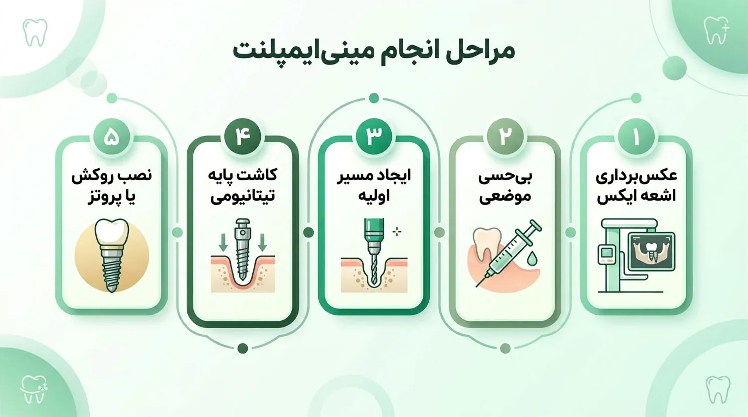 مراحل انجام مینی ایمپلنت mini implant steps