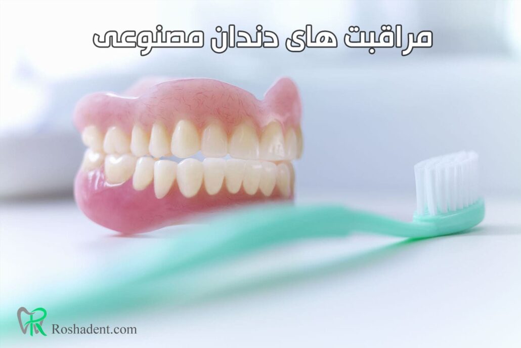 مراقبت های دندان مصنوعی