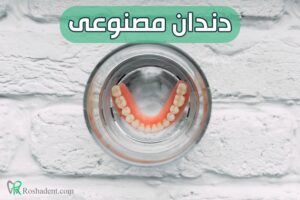 دندان مصنوعی Denture