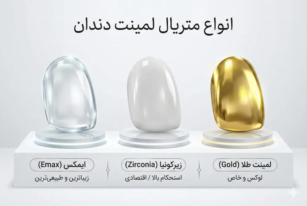 انواع مواد لمینت دندان dental laminate price