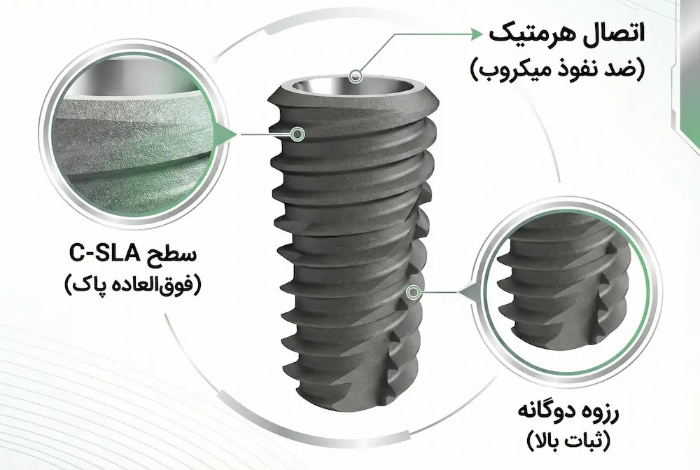 تکنولوژی ساخت ایمپلنت دنتیس dentis implant technical features