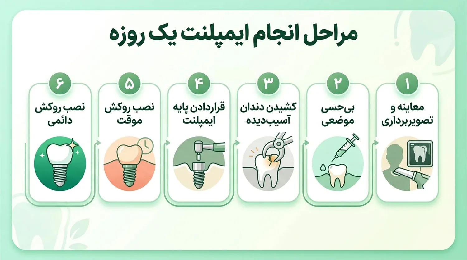 مراحل ایمپلنت فوری مراحل ایمپلنت یک روزه Immediate Load steps