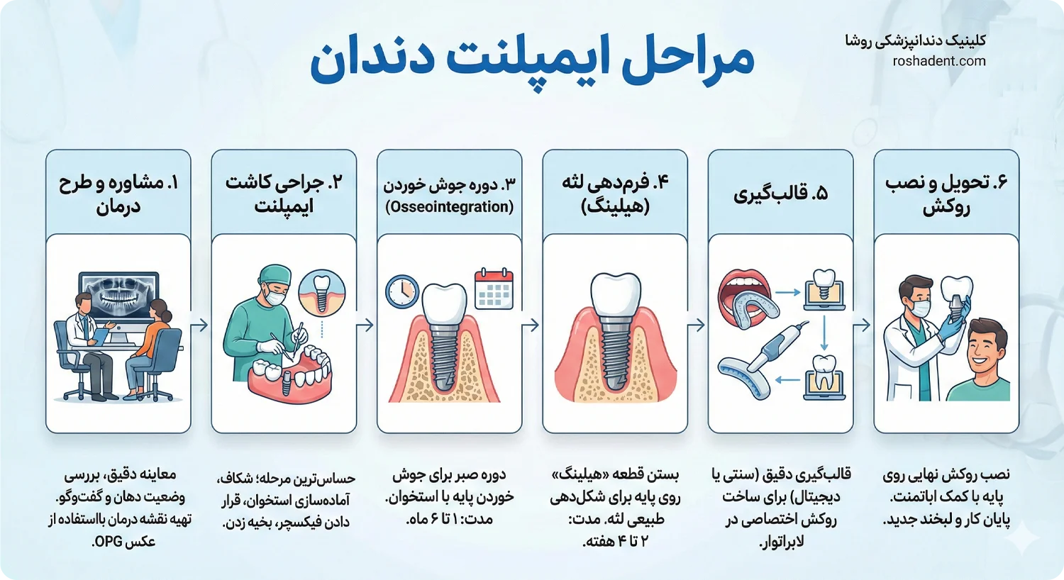 مراحل کاشت ایمپلنت دندان چگونه انجام میشود 