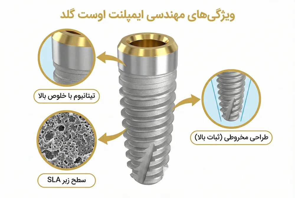 تکنولوژی ساخت ایمپلنت اوست گلد avest gold technical engineering