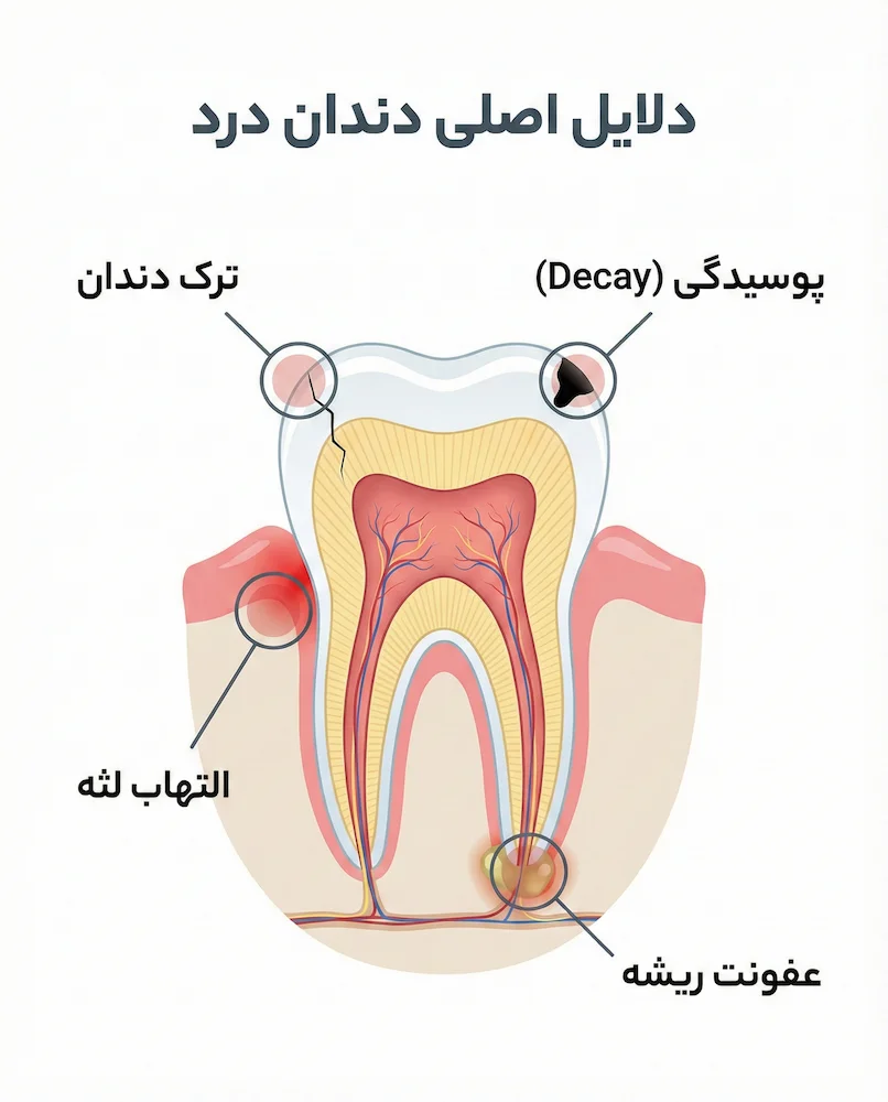 انواع علل درد دندان causes of toothache