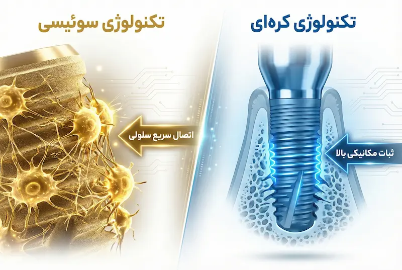 مقایسه فنی ایمپلنت سوئیسی و کره‌ای korean-vs-swiss-implant-Technical-comparison