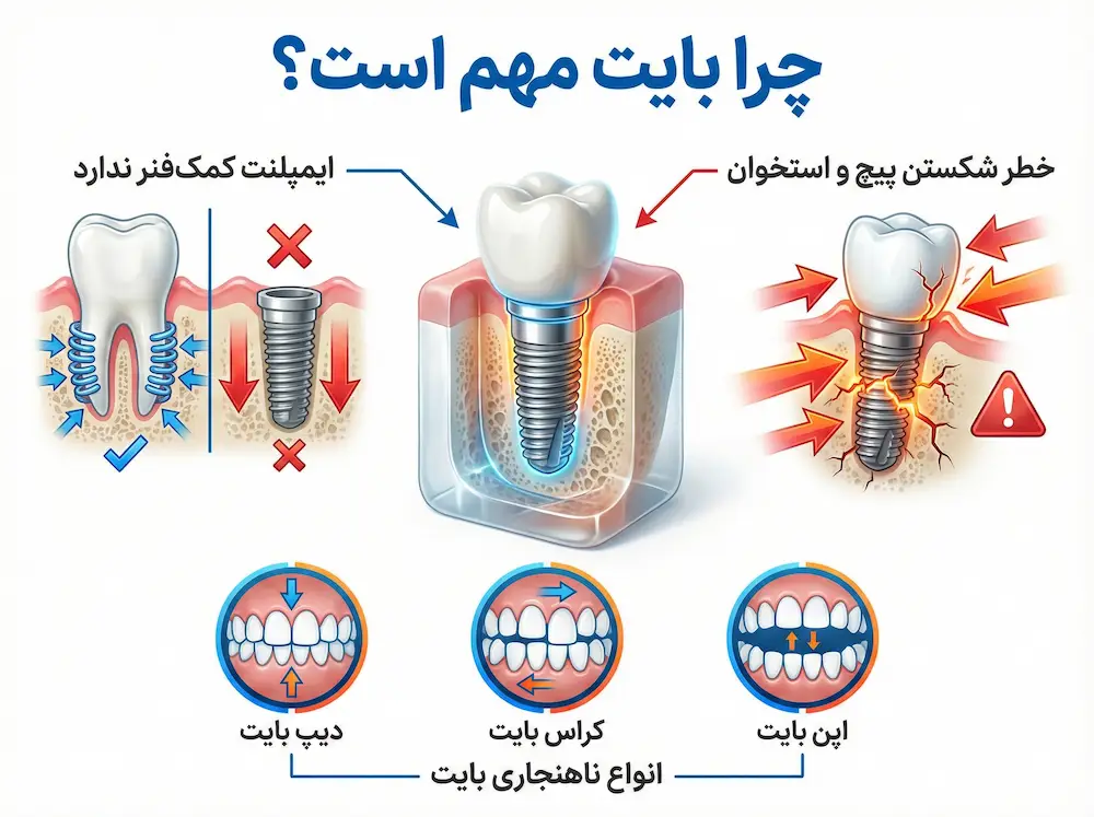 چرا بایت دندانی مهم است why dental bites is important