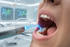 Repairing tooth decay with human hair protein