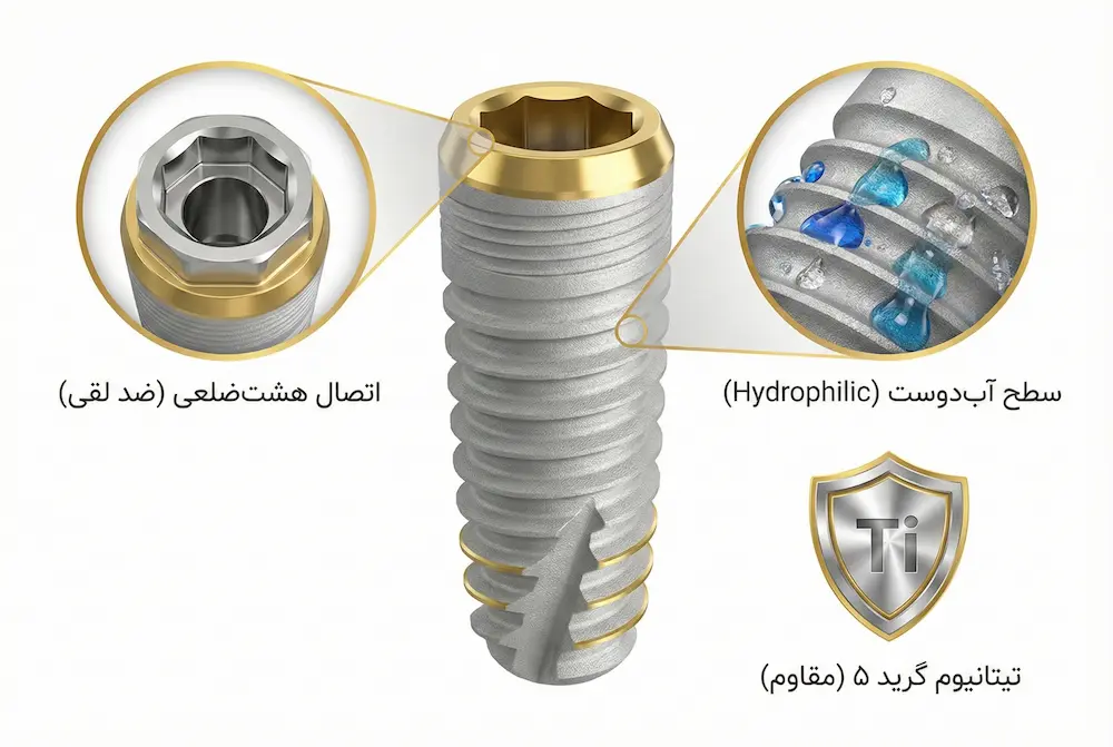 تکنولوژی ساخت ایمپلنت اف اند بی f and b technical features