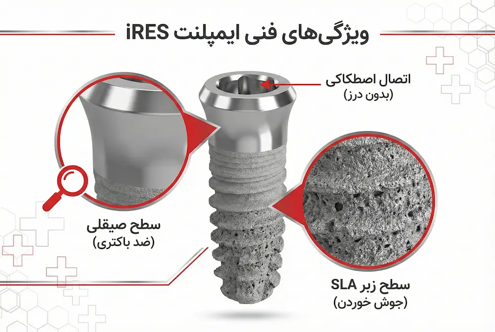 تکنولوژی ساخت ایمپلنت آیرس ires implant technical features