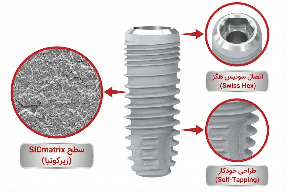 تکنولوژی ساخت ایمپلنت اس آی سی sic implant technical features