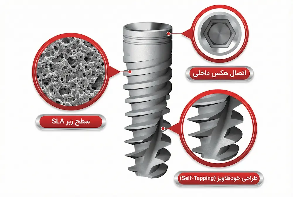 تکنولوژی ساخت ایمپلنت اس پی آی spi implant technical features