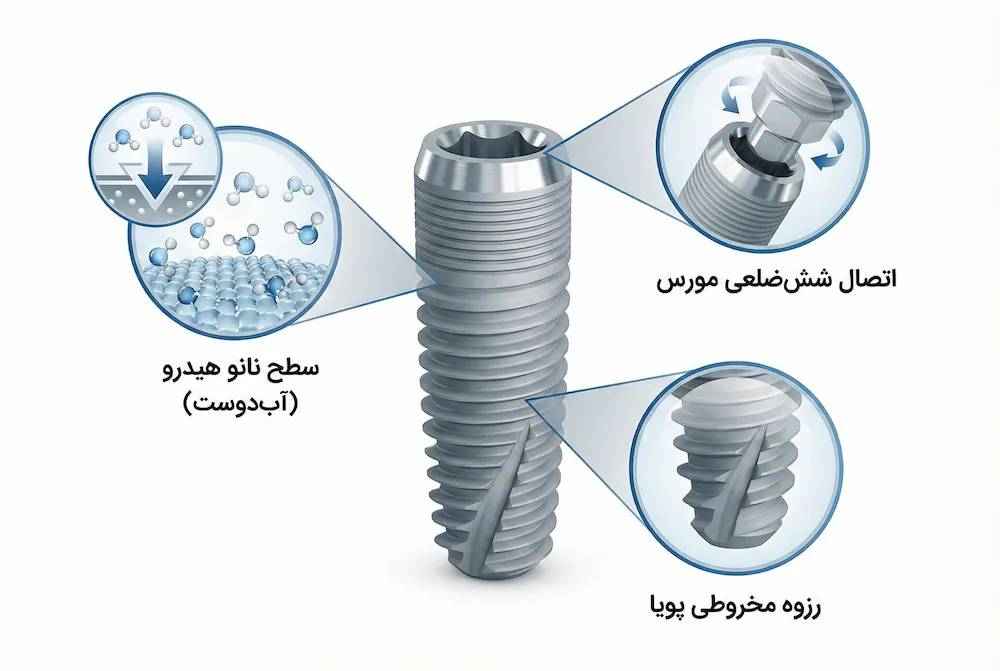 تکنولوژی ساخت ایمپلنت وارانتک warantec implant technical features