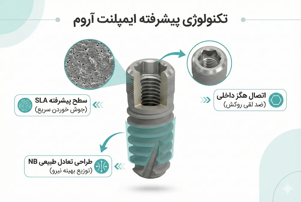 تکنولوژی و ویژگی های ایمپلنت آروم arum dental implant technical features