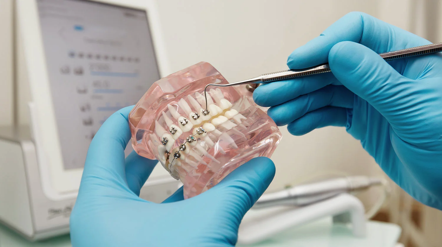 ارتودنسی چیست؟ WHAT IS ORTHODONTICS هدف و کاربرد ارتودنسی دندان چیست؟