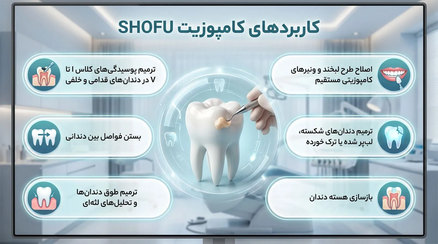 کاربردهای کامپوزیت شوفو shofu composite uses