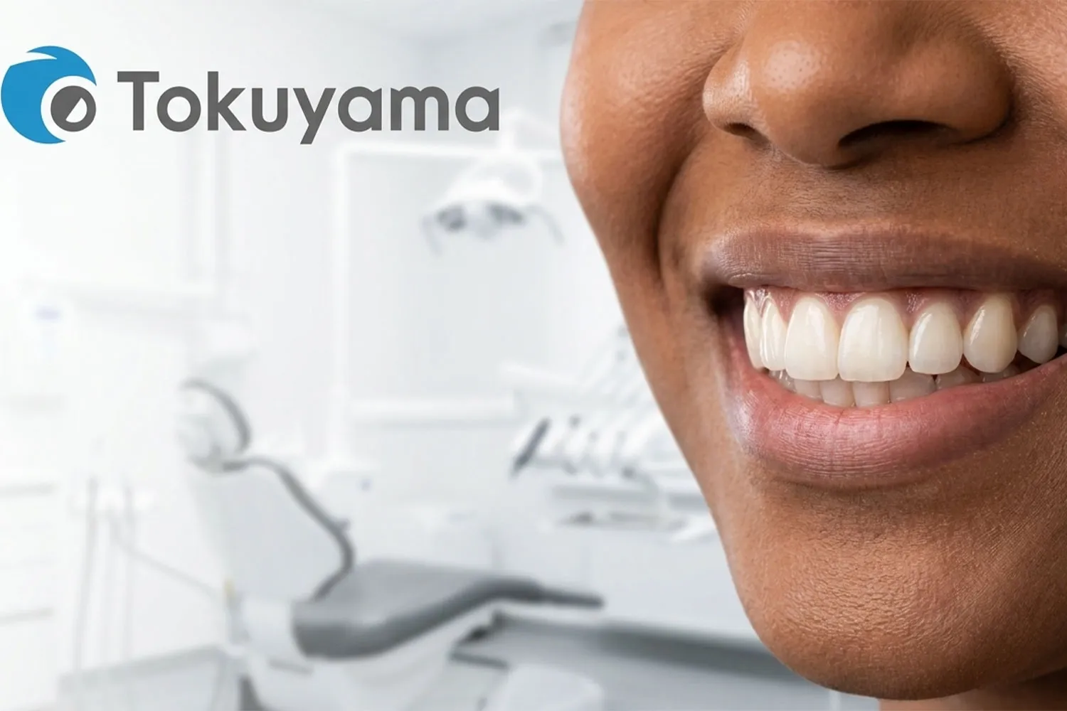 کامپوزیت توکویاما tokuyama composite